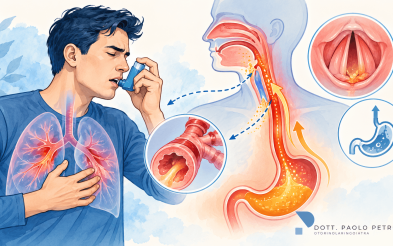Asma, reflusso gastroesofageo e reflusso laringofaringeo: c’è una connessione? Il punto di vista dell’otorinolaringoiatra