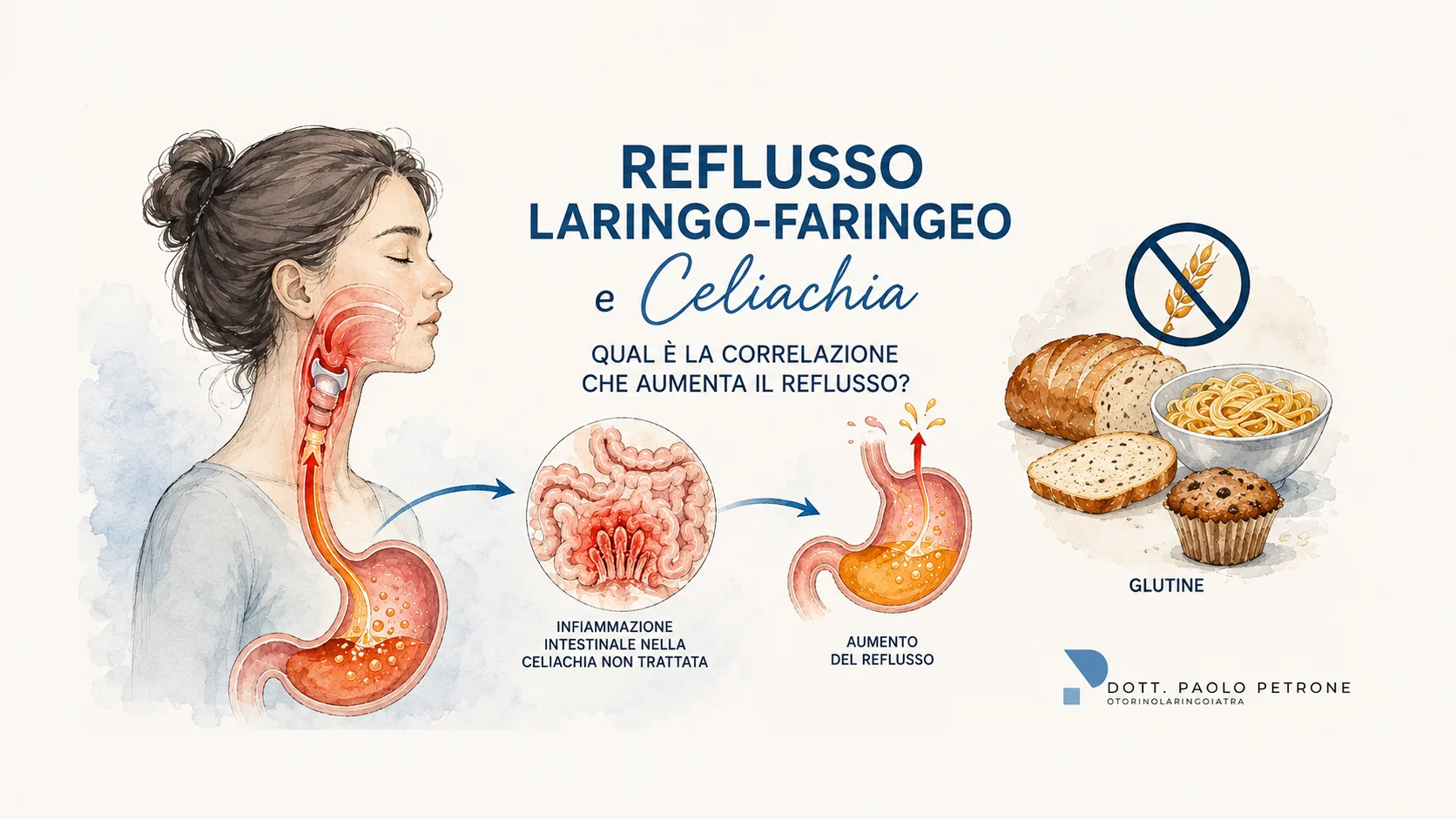 Reflusso laringo-faringeo e celiachia: c’è una correlazione che può aumentare il reflusso nelle alte vie respiratorie? L’opinione dell’otorino