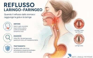 Il reflusso laringo-faringeo (LPR). Guida completa: sintomi, diagnosi, cure e quando rivolgersi all’otorinolaringoiatra